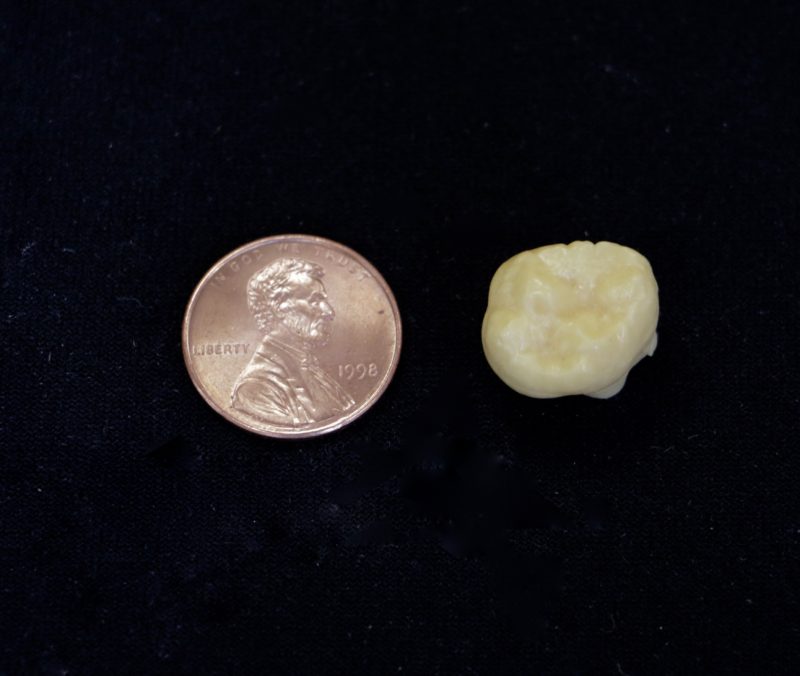 Natalia Reagan's photo of a Denisovan tooth, shown next to a penny for scale.