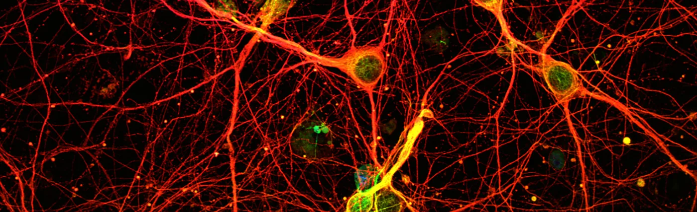 Mouse cortical neurons