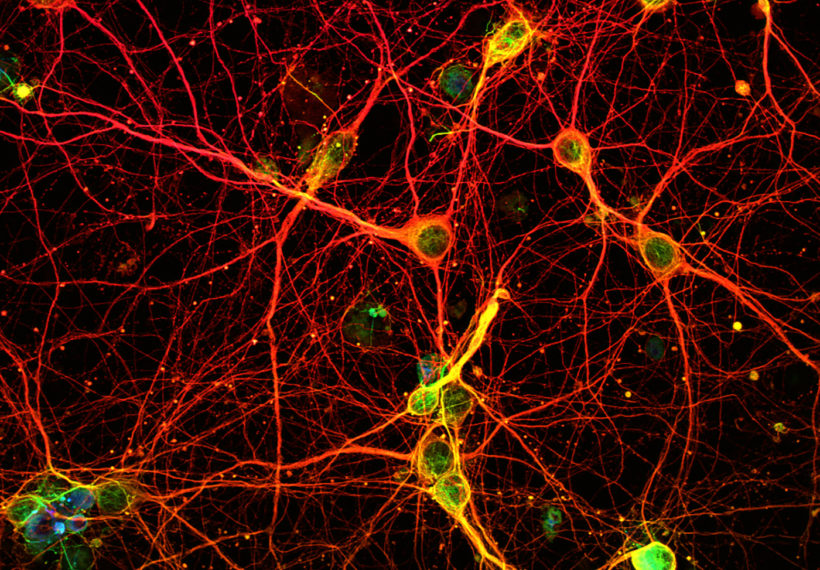 Mouse cortical neurons