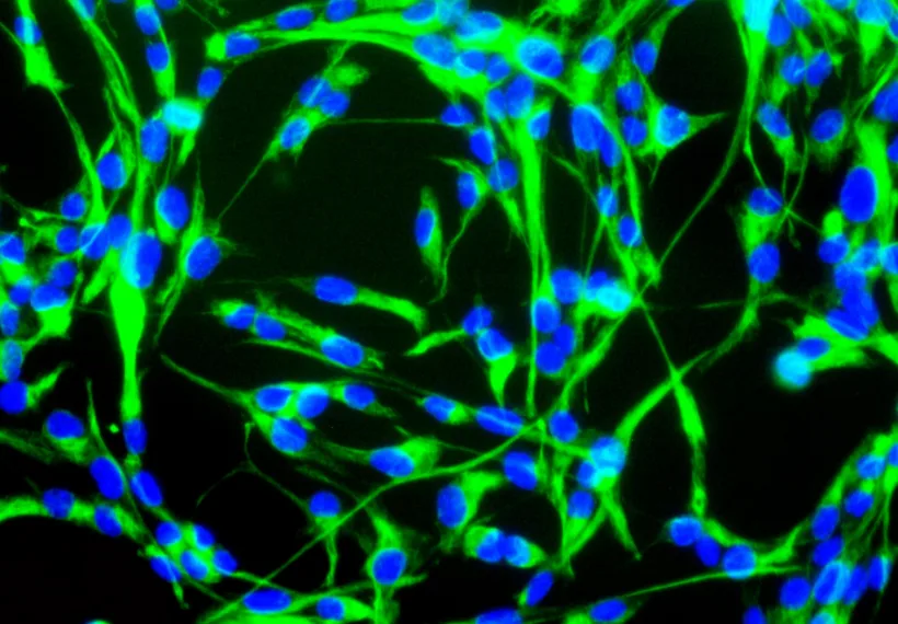 Mouse neural stem cells growing in culture. Neural stem cells can be made to develop into cells found in the central nervous system; neurons, astrocytes and oligodendrocytes.