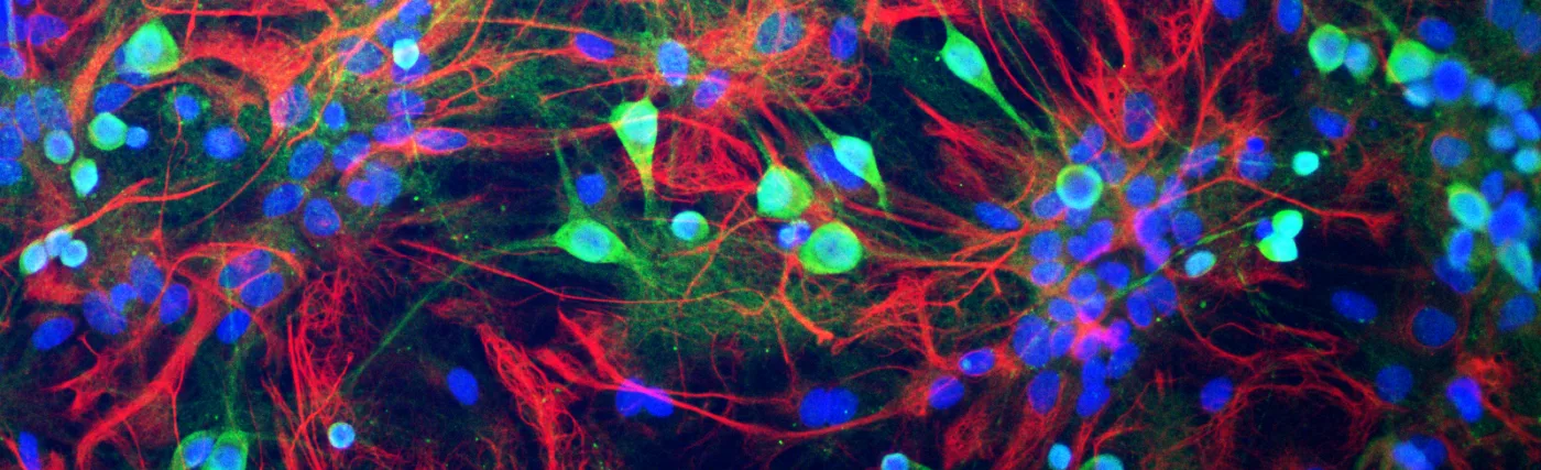 Neurons from rat brain tissue stained green with antibody to ubiquitin C-terminal hydrolase L1 (UCH-L1) which highlights the cell body strongly and the cell processes more weakly.