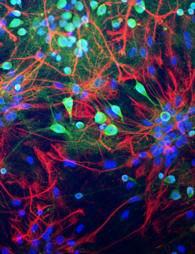 Neurons from rat brain tissue stained green with antibody to ubiquitin C-terminal hydrolase L1 (UCH-L1) which highlights the cell body strongly and the cell processes more weakly.