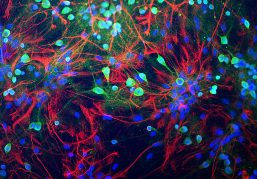 Neurons from rat brain tissue stained green with antibody to ubiquitin C-terminal hydrolase L1 (UCH-L1) which highlights the cell body strongly and the cell processes more weakly.