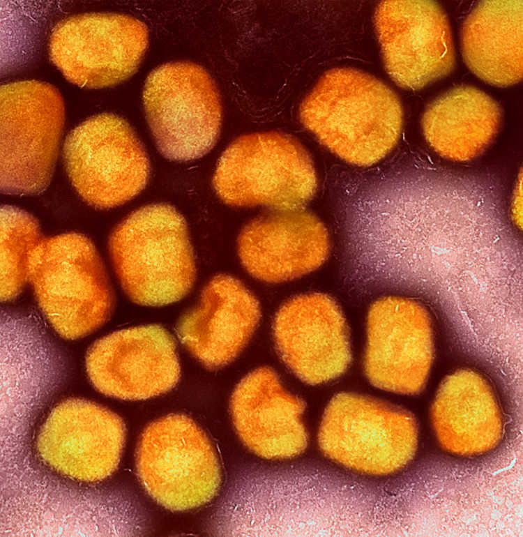 Colorized transmission electron micrograph of monkeypox virus particles (gold) cultivated and purified from cell culture. Image captured at the NIAID Integrated Research Facility (IRF) in Fort Detrick, Maryland. Credit: NIAID