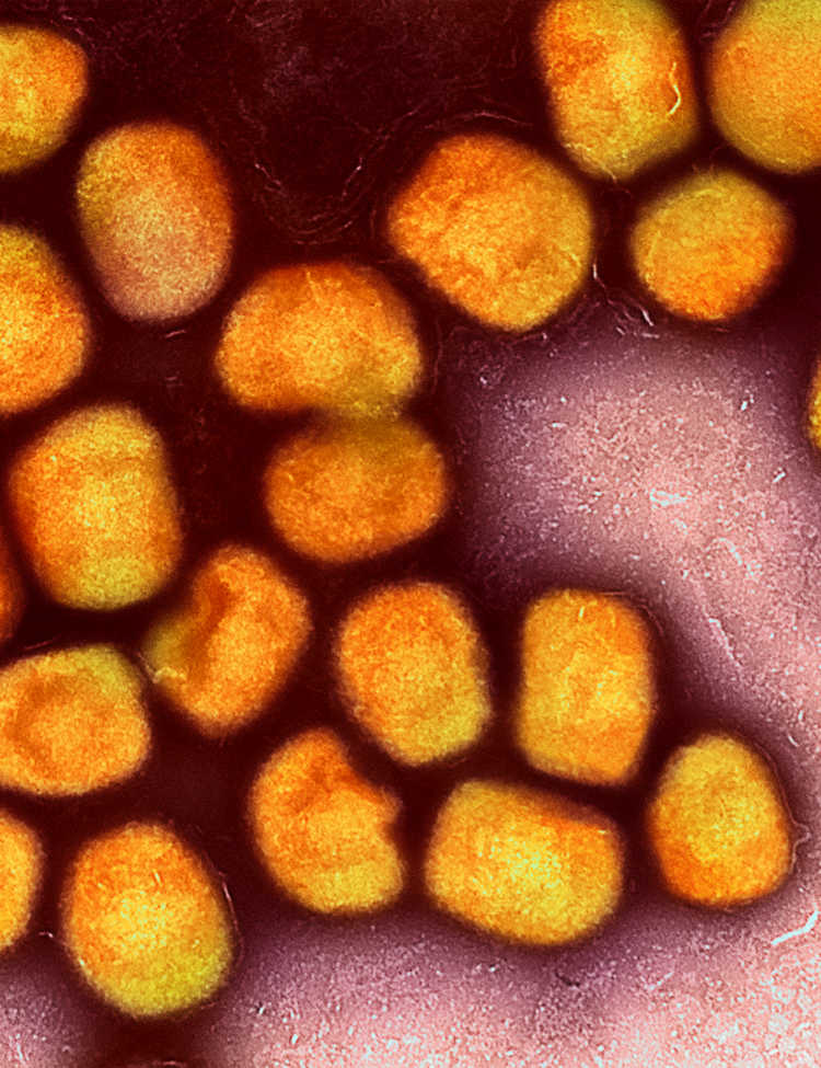 Colorized transmission electron micrograph of monkeypox virus particles (gold) cultivated and purified from cell culture. Image captured at the NIAID Integrated Research Facility (IRF) in Fort Detrick, Maryland. Credit: NIAID