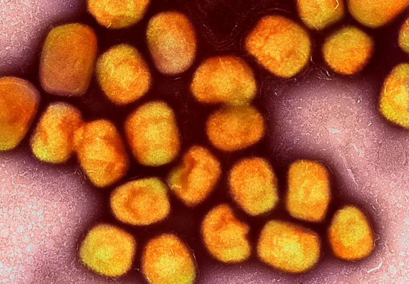 Colorized transmission electron micrograph of monkeypox virus particles (gold) cultivated and purified from cell culture. Image captured at the NIAID Integrated Research Facility (IRF) in Fort Detrick, Maryland. Credit: NIAID