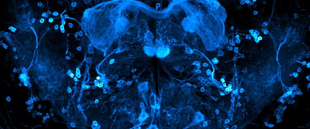 Brain of Drosophila melanogaster with reward neurons (0104-Gal4 driver) highlighted