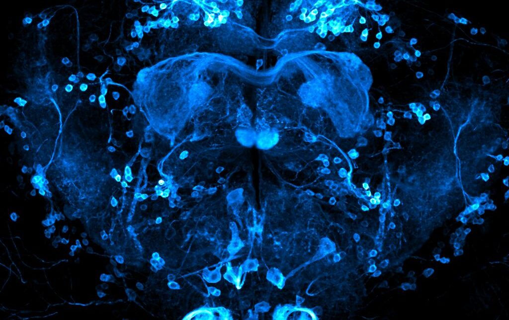 Brain of Drosophila melanogaster with reward neurons (0104-Gal4 driver) highlighted