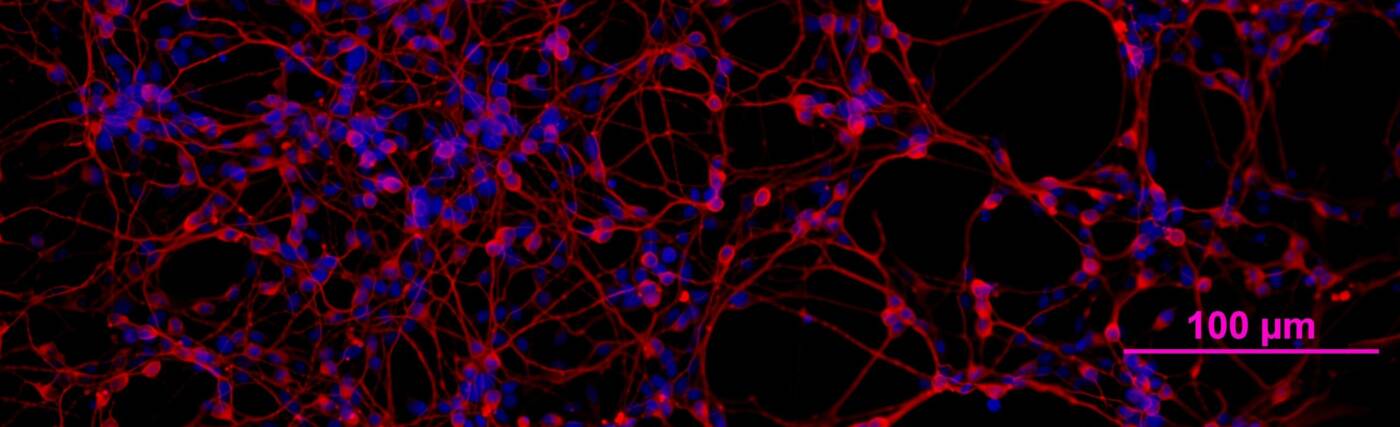 CDI iCell Neurons with beta-III tubulin (a neuronal marker) stained red and nuclei stained blue with Hoechst