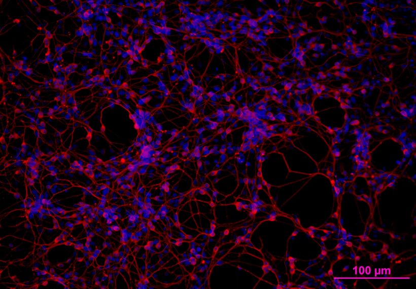 CDI iCell Neurons with beta-III tubulin (a neuronal marker) stained red and nuclei stained blue with Hoechst