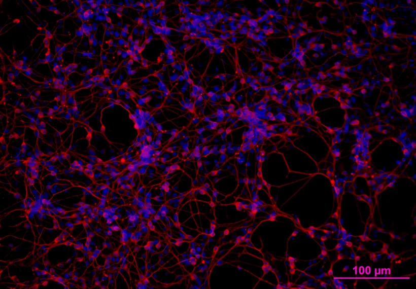 CDI iCell Neurons with beta-III tubulin (a neuronal marker) stained red and nuclei stained blue with Hoechst