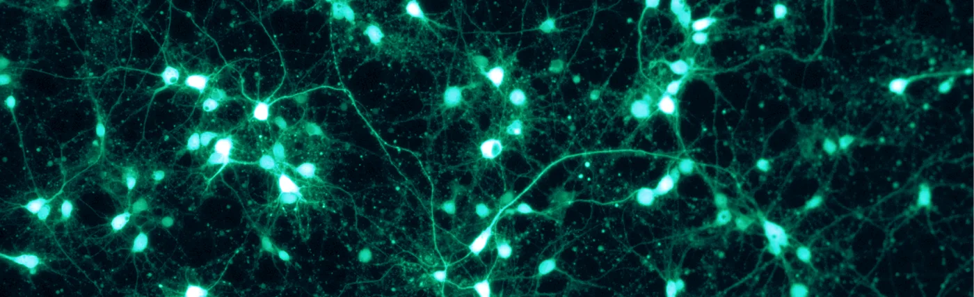 Shown are rat cortical neurons, grown in vitro on a PLL/Lam-coated coverslip, and transfected with a virus to express GFP. This fluorescence picture was taken through a Zeiss Axiovert microscope with the appropriate GFP filter settings.