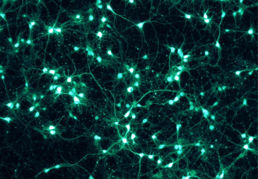 Shown are rat cortical neurons, grown in vitro on a PLL/Lam-coated coverslip, and transfected with a virus to express GFP. This fluorescence picture was taken through a Zeiss Axiovert microscope with the appropriate GFP filter settings.