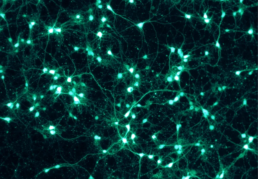 Shown are rat cortical neurons, grown in vitro on a PLL/Lam-coated coverslip, and transfected with a virus to express GFP. This fluorescence picture was taken through a Zeiss Axiovert microscope with the appropriate GFP filter settings.
