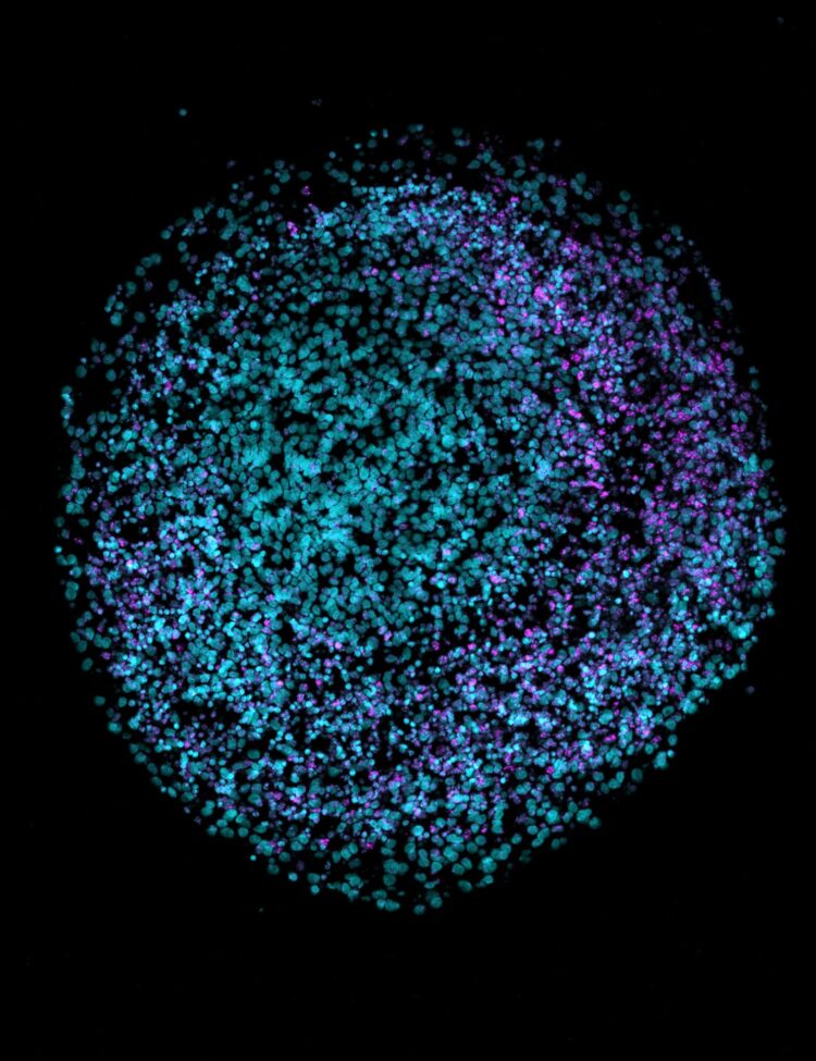 English: 2D cryosection of a human brain organoid stained with DAPI (teal) and VIPR2 (magenta).