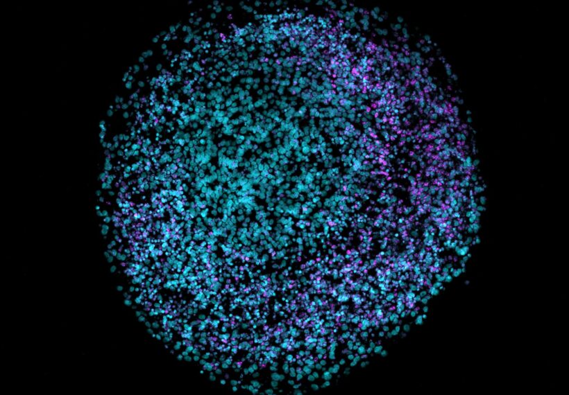 English: 2D cryosection of a human brain organoid stained with DAPI (teal) and VIPR2 (magenta).