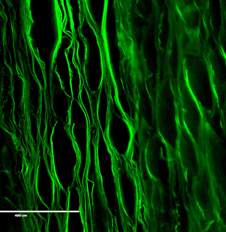 Lamellar scaffold prepared from silk fibroin for inter vertebral disc tissue engineering. This lamellar structure mimic the structural environment of IVD.