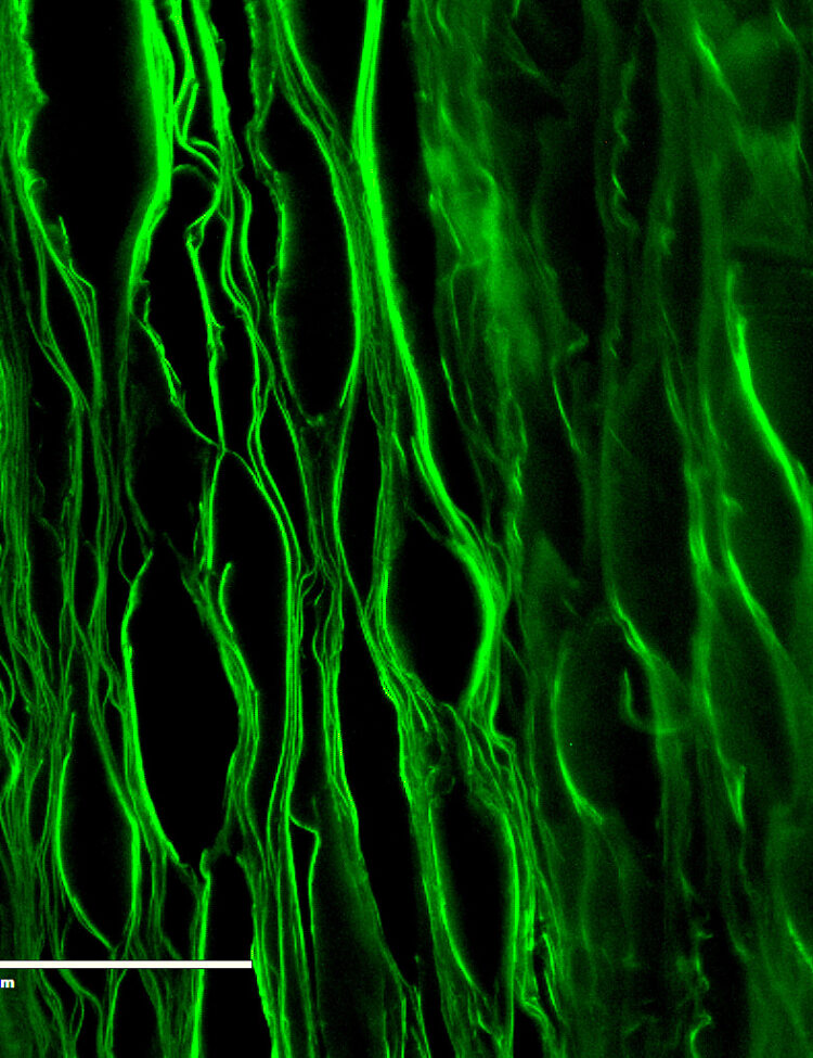 Lamellar scaffold prepared from silk fibroin for inter vertebral disc tissue engineering. This lamellar structure mimic the structural environment of IVD.