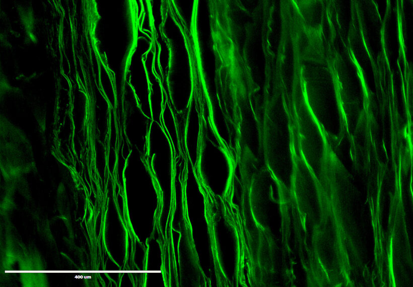 Lamellar scaffold prepared from silk fibroin for inter vertebral disc tissue engineering. This lamellar structure mimic the structural environment of IVD.