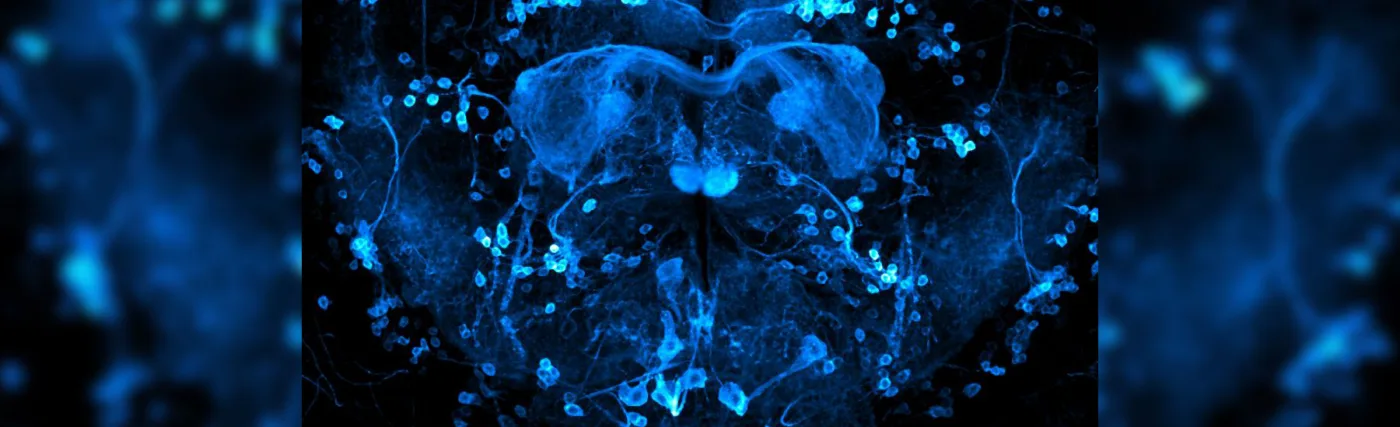 Brain of Drosophila melanogaster with reward neurons (0104-Gal4 driver) highlighted