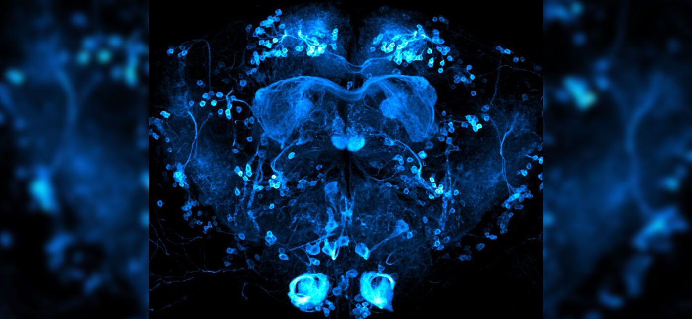 Brain of Drosophila melanogaster with reward neurons (0104-Gal4 driver) highlighted