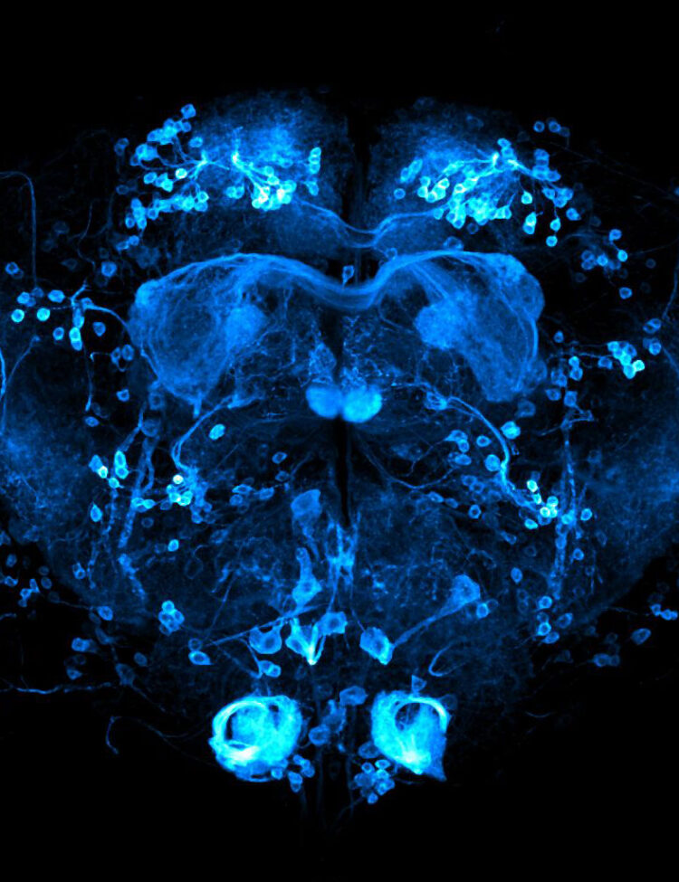 Brain of Drosophila melanogaster with reward neurons (0104-Gal4 driver) highlighted