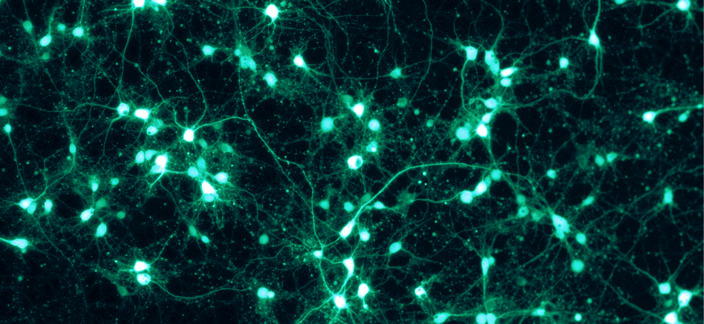 Shown are rat cortical neurons, grown in vitro on a PLL/Lam-coated coverslip, and transfected with a virus to express GFP. This fluorescence picture was taken through a Zeiss Axiovert microscope with the appropriate GFP filter settings.