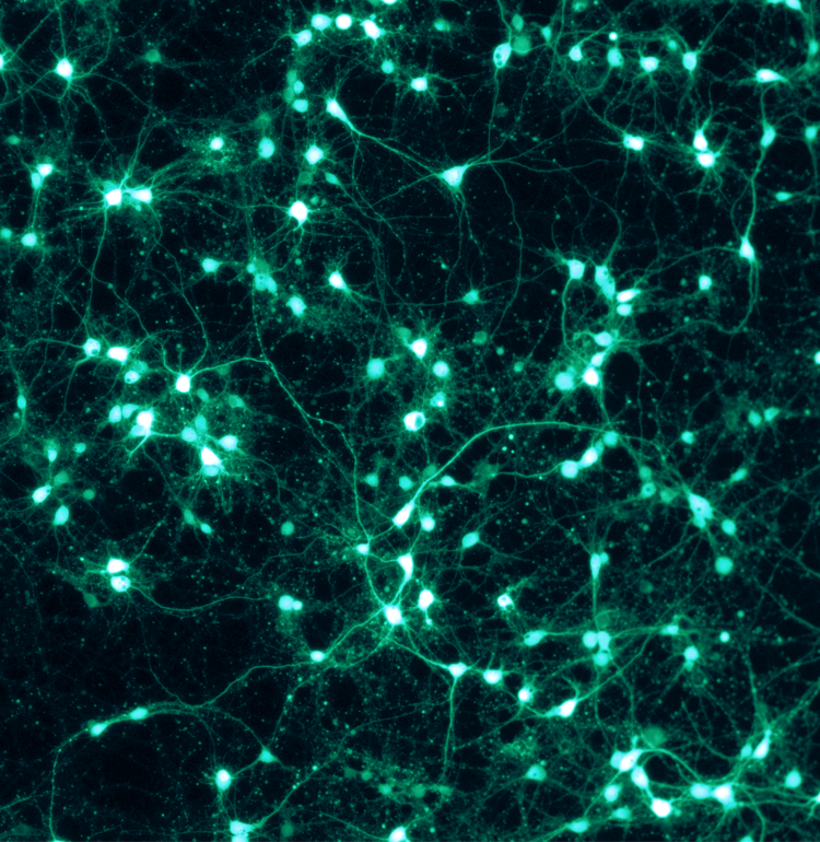 Shown are rat cortical neurons, grown in vitro on a PLL/Lam-coated coverslip, and transfected with a virus to express GFP. This fluorescence picture was taken through a Zeiss Axiovert microscope with the appropriate GFP filter settings.