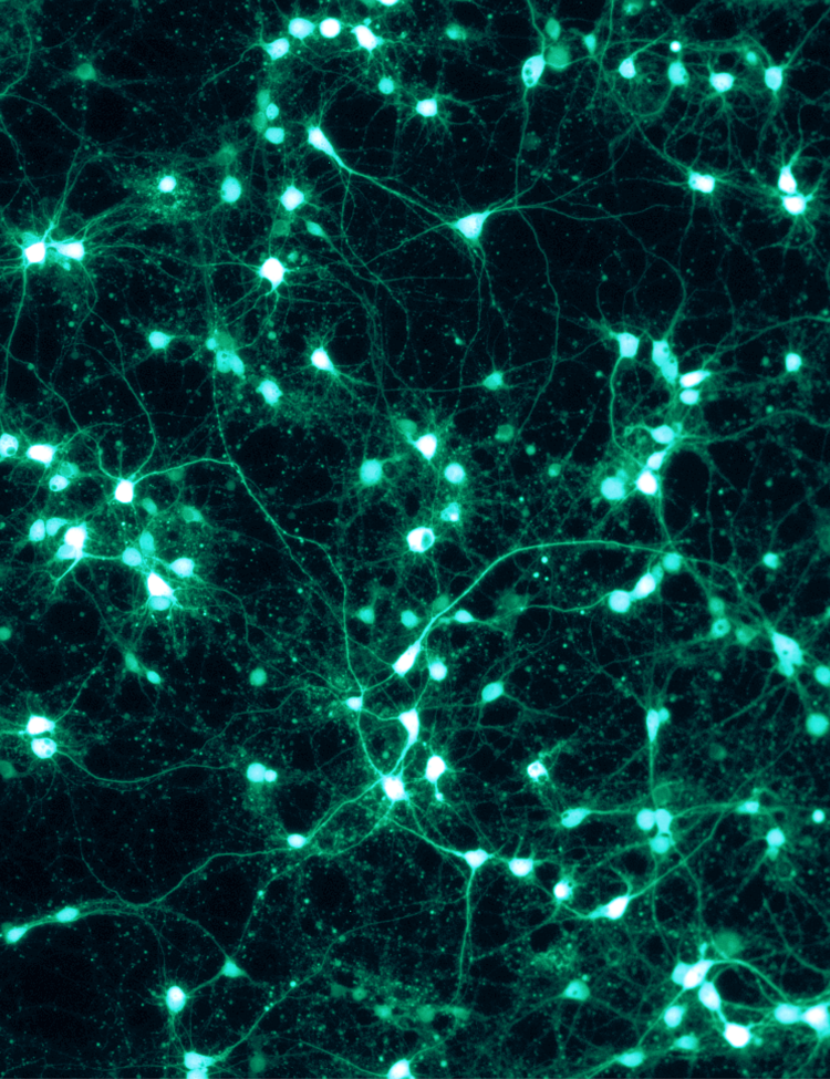 Shown are rat cortical neurons, grown in vitro on a PLL/Lam-coated coverslip, and transfected with a virus to express GFP. This fluorescence picture was taken through a Zeiss Axiovert microscope with the appropriate GFP filter settings.