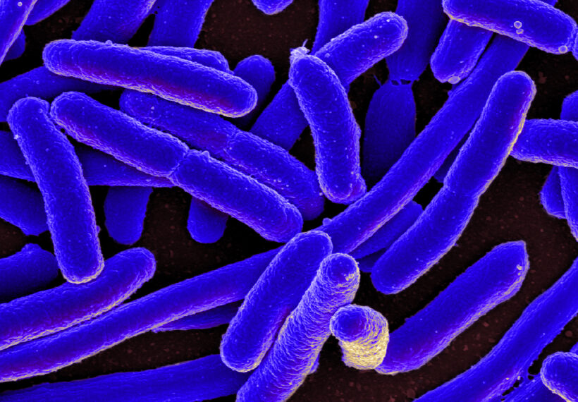 Colorized scanning electron micrograph of Escherichia coli, grown in culture and adhered to a cover slip.