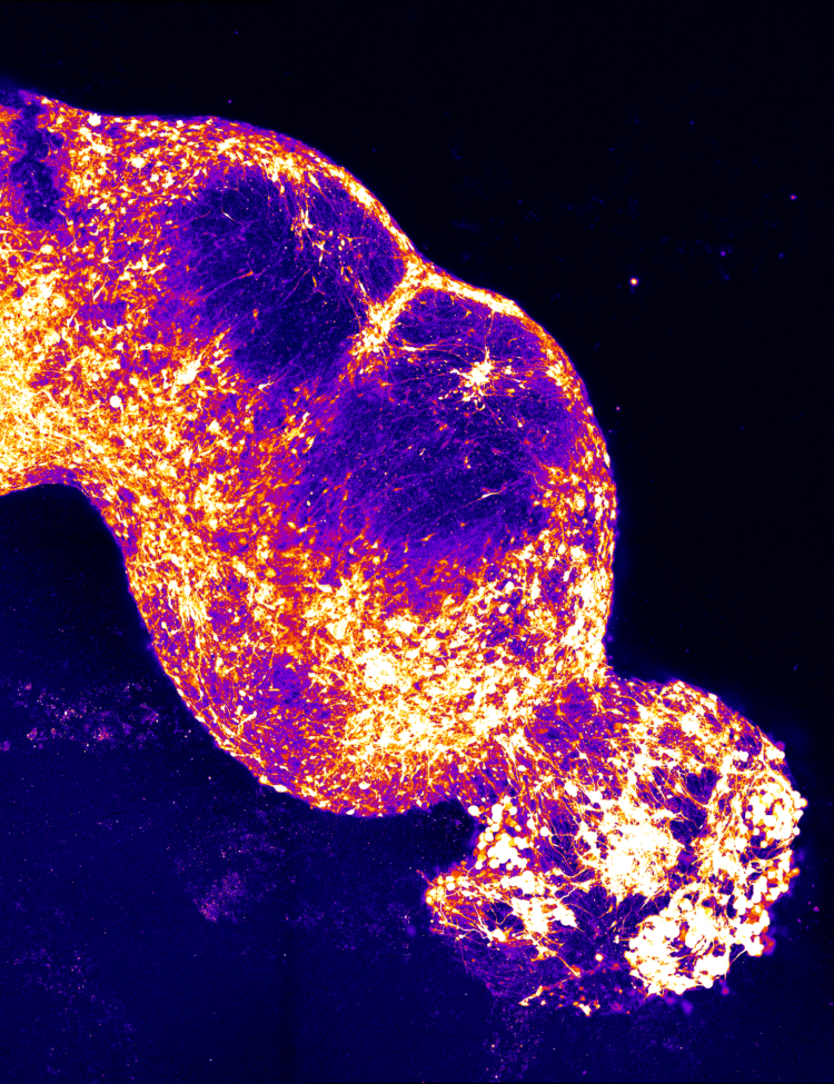 Four-part Assembloid modeling the pain pathway.