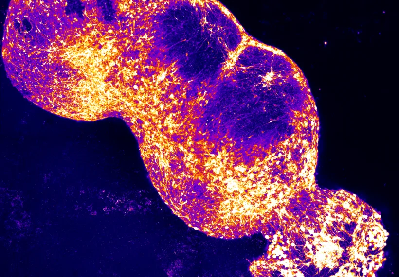 Four-part Assembloid modeling the pain pathway.