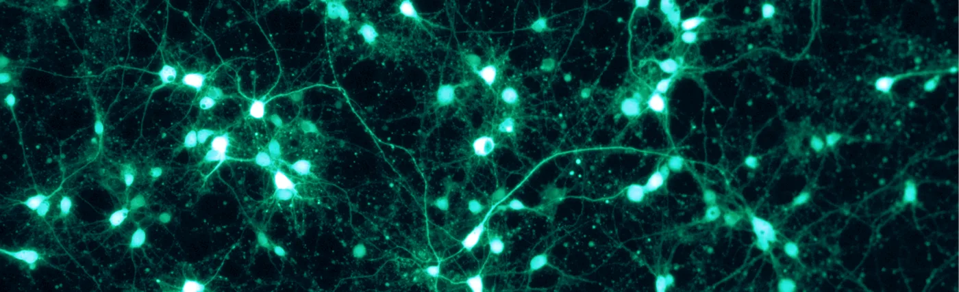 Shown are rat cortical neurons, grown in vitro on a PLL/Lam-coated coverslip, and transfected with a virus to express GFP. This fluorescence picture was taken through a Zeiss Axiovert microscope with the appropriate GFP filter settings.