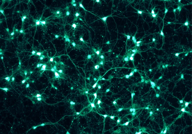 Shown are rat cortical neurons, grown in vitro on a PLL/Lam-coated coverslip, and transfected with a virus to express GFP. This fluorescence picture was taken through a Zeiss Axiovert microscope with the appropriate GFP filter settings.