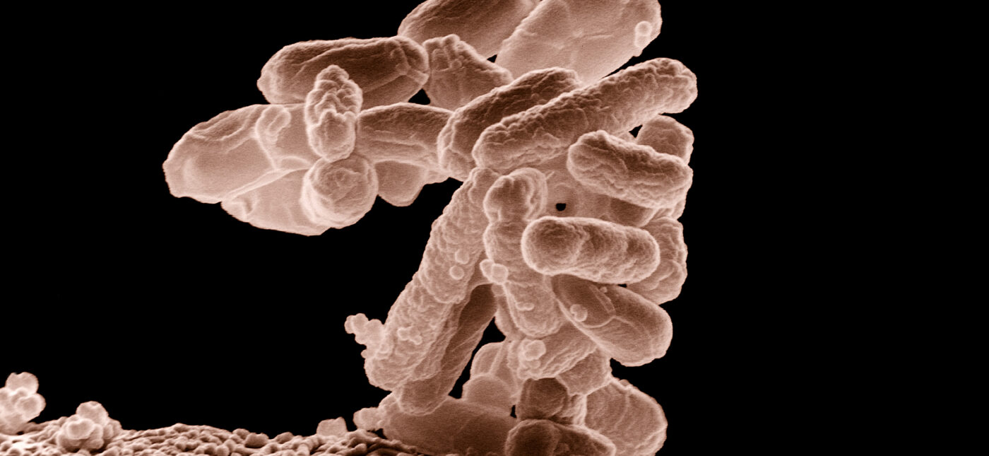 Low-temperature electron micrograph of a cluster of E. coli bacteria, magnified 10,000 times. Each individual bacterium is oblong shaped.