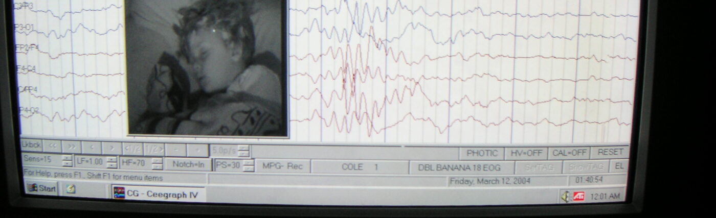 EEG record of brain activity and wave patterns from a sleeping boy.