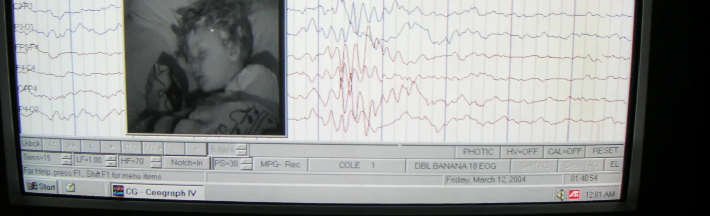 EEG record of brain activity and wave patterns from a sleeping boy.