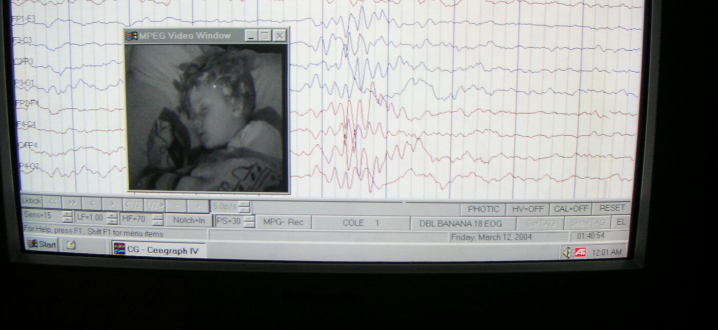 EEG record of brain activity and wave patterns from a sleeping boy.
