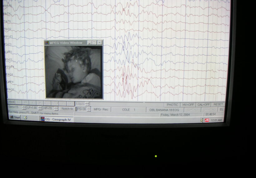 EEG record of brain activity and wave patterns from a sleeping boy.