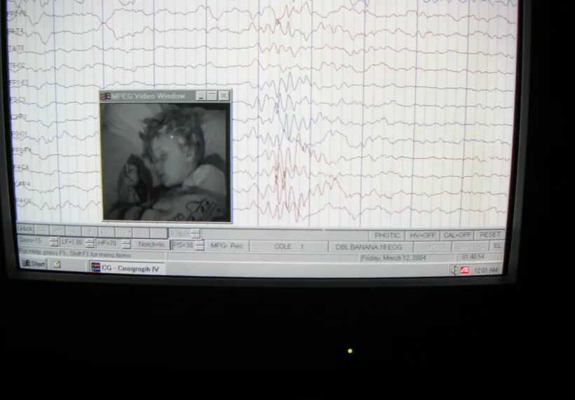 EEG record of brain activity and wave patterns from a sleeping boy.